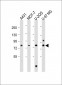 PLOD1 Antibody (N-term)