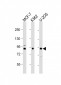 PLOD1 Antibody (N-term)