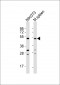 M Mlkl Antibody (C-term)
