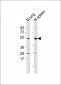 Mlkl Antibody (C-term)