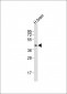 DRD2 Antibody (C-term)