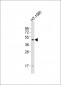 DRD2 Antibody (C-term)