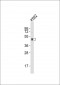 DRD2 Antibody (C-term)