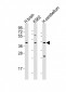 DRD2 Antibody (C-term)