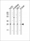 HAVCR2 Antibody (Center)