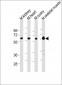 Lyn Antibody (Center)