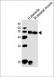 DLK1 Antibody (C-term)