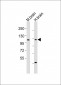 CHSY3 Antibody (Center)