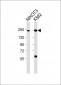 (Mouse) Smarca4 Antibody (C-term)