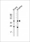 (Mouse) Epcam Antibody (C-term)