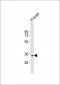 NANOG Antibody (Center)