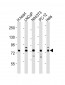 DNM1L Antibody (C-term)