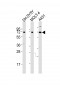 HTR2C Antibody (Center)