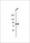 AKAP8 Antibody (Center)