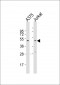 CCR1 Antibody (N-term)