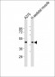 CCR1 Antibody (N-term)