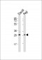 HLA-DQA1 Antibody (N-term)