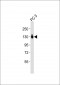 ITGA3 Antibody (N-term)