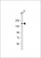 ITGA3 Antibody (C-term)