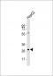 KCNMB2 Antibody (C-term)