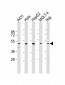 CYP24A1 Antibody (N-term)