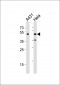 CYP24A1 Antibody (C-term)