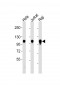 ITGA7 Antibody (C-term)