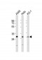PYCRL Antibody (C-term)