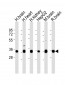 KCNMB2 Antibody (N-term)