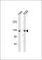 ZFYVE20 Antibody (N-Term)