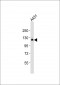 ZFYVE20 Antibody (N-Term)