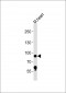 Mouse Rps6ka5 Antibody (C-term)