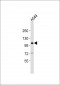 CHSY3 Antibody (C-term)