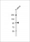 CHSY3 Antibody (C-term)