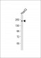 RICTOR Antibody (Center)