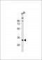 TNFRSF14 Antibody (C-term)