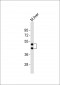 HPN Antibody (Center)