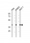 HPN Antibody (Center)