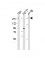 Mouse Med12 Antibody (C-term)