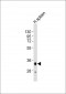 HLA-DQA1 Antibody (C-term)