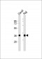 HLA-DQA1 Antibody (C-term)