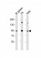 SUZ12 Antibody (Center)