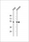 PRKAR2A Antibody (C-Term)