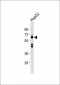 SLC2A1 Antibody (C-term)