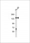 SEMA4D Antibody (Center)