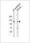 UNC5B Antibody (Center)