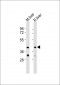 IL12B Antibody