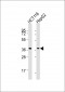 CTSL Antibody (N-Term)