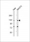 AATK Antibody (N-Term)