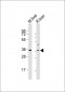 ACOT8 Antibody (C-term)